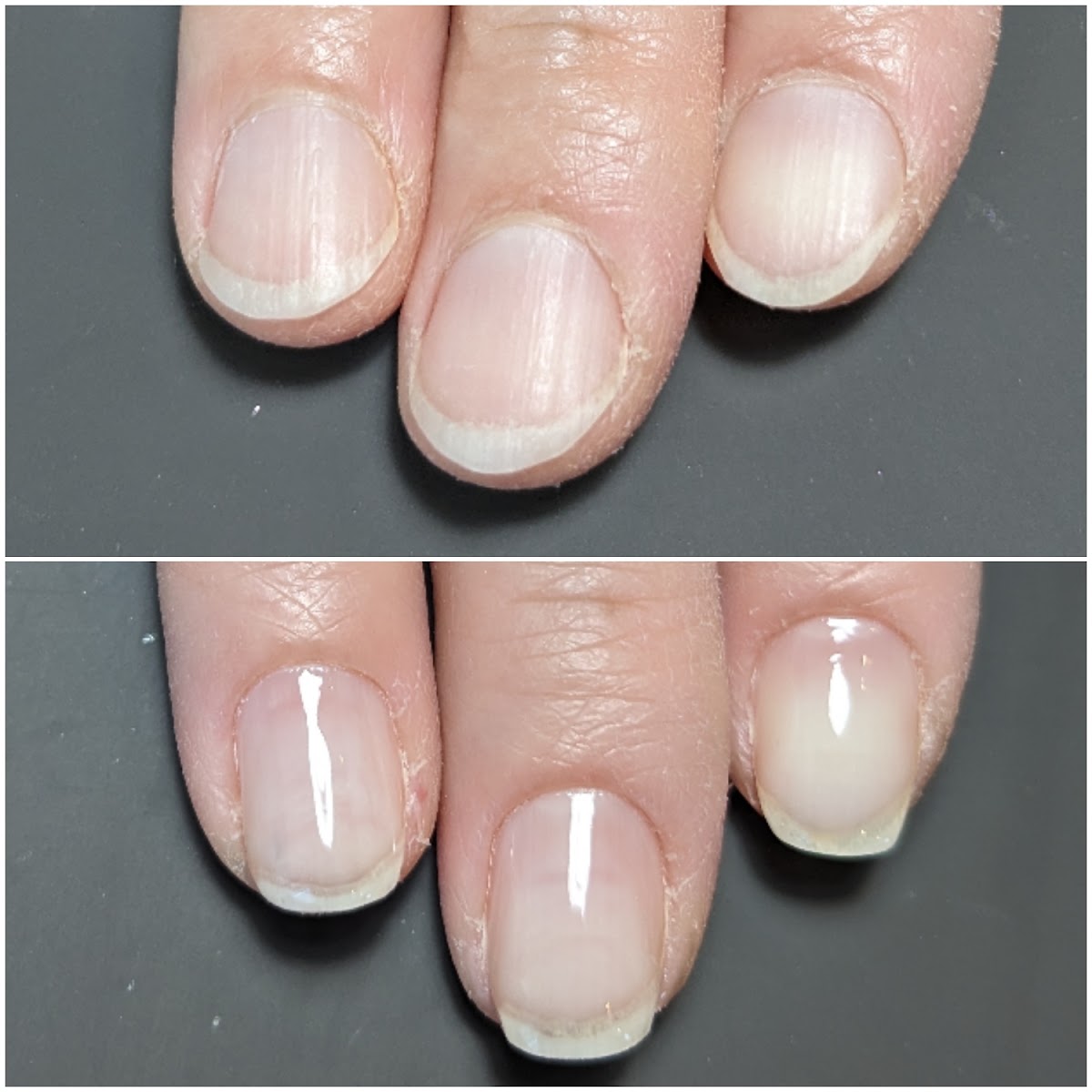 症例 Before After