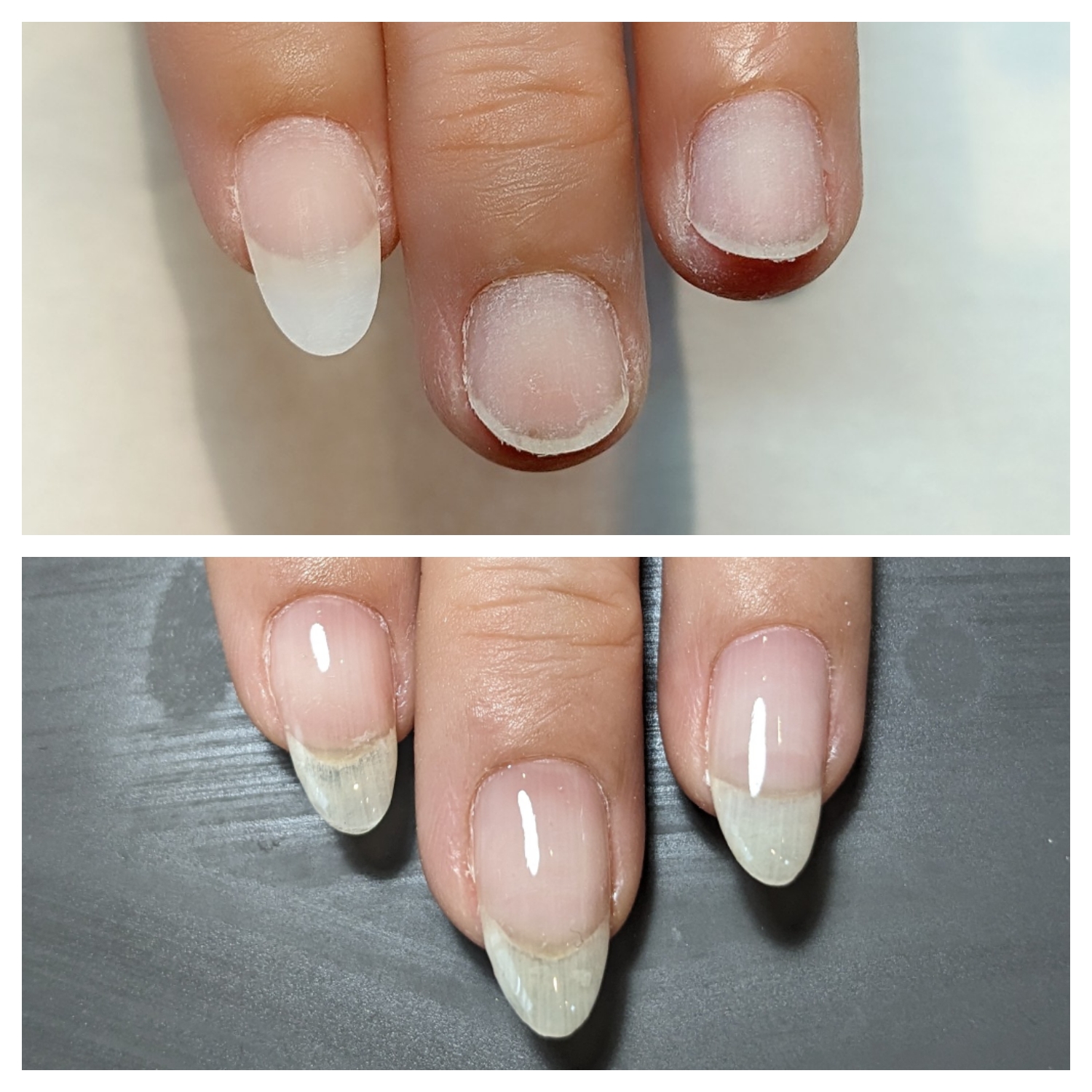 症例 Before After
