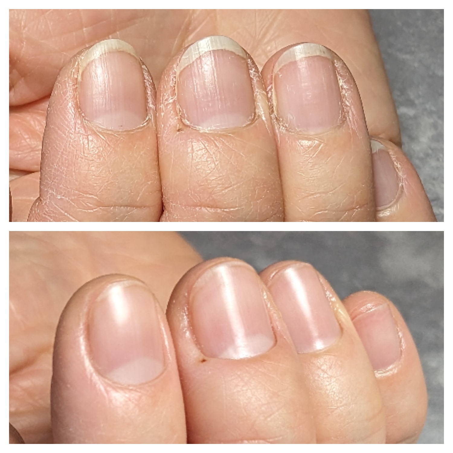 症例 Before After